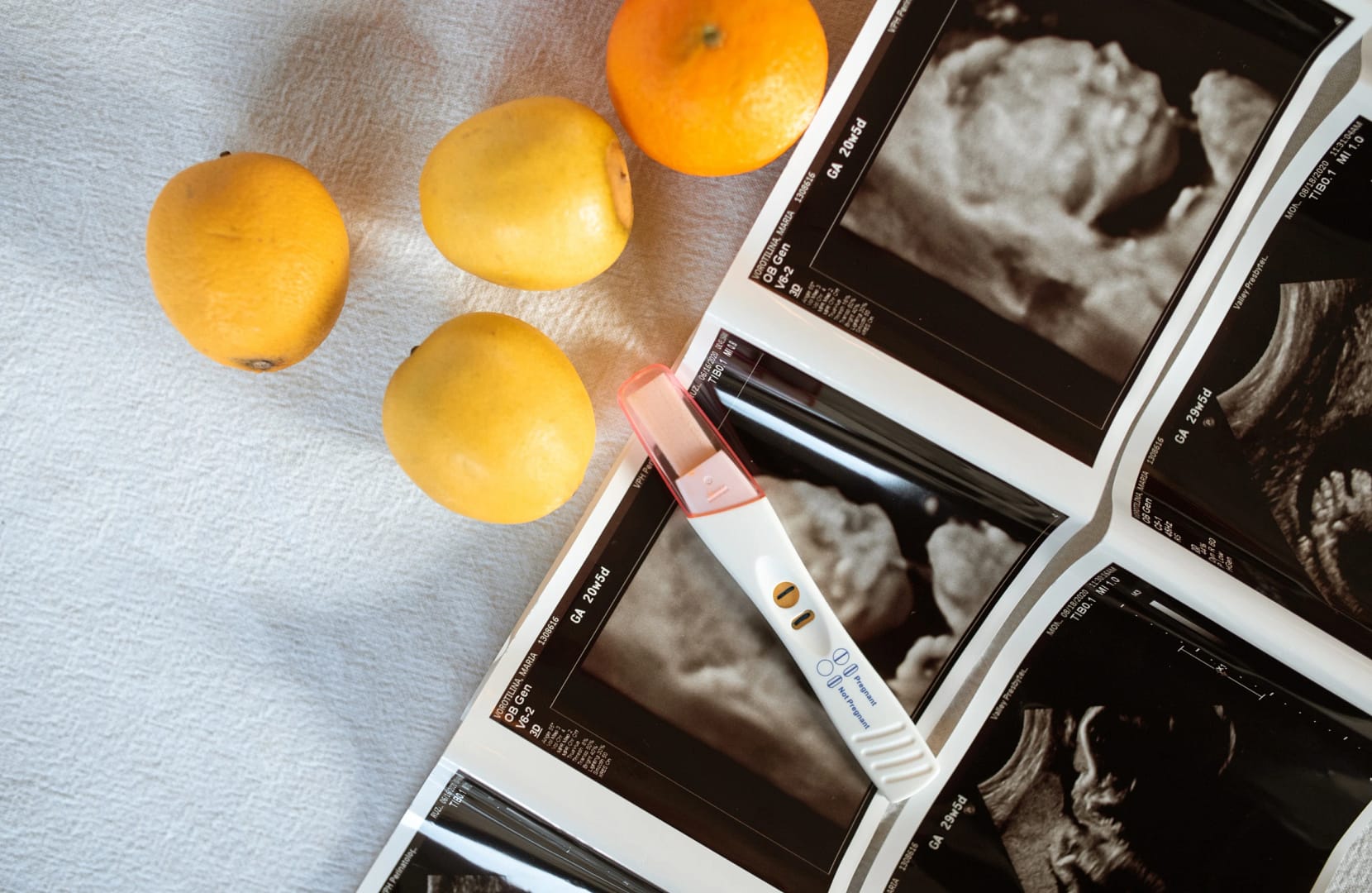 Ultrasound scan and pregnancy test kit symbolizing expert fertility planning in Secunderabad